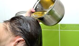 أسباب تساقط الشعر